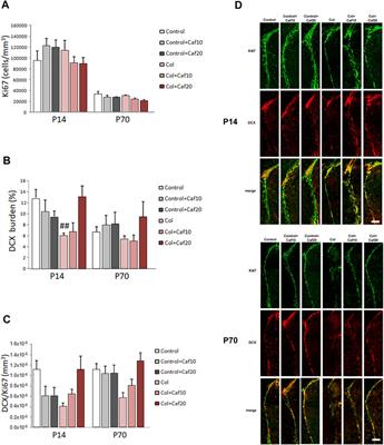 Caffeine Restores Neuronal Damage and Inflammatory Response in a Model of Intraventricular Hemorrhage of the Preterm Newborn